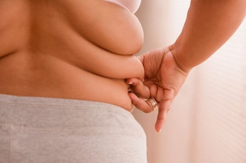 10 физических уродств от болезней или состоянийОжирение (Obesity)